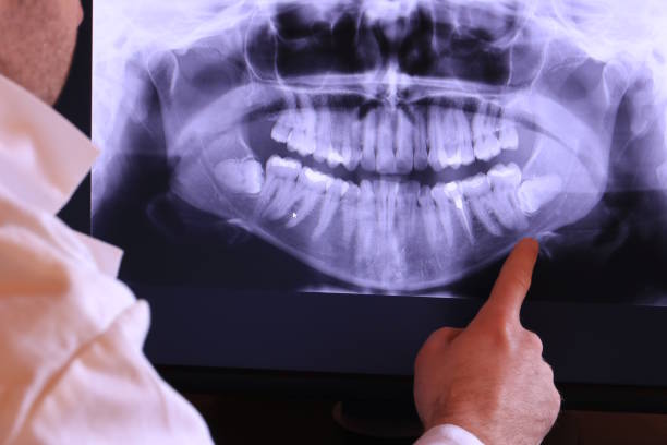 Tooth Infection Emergency Dentist in MO