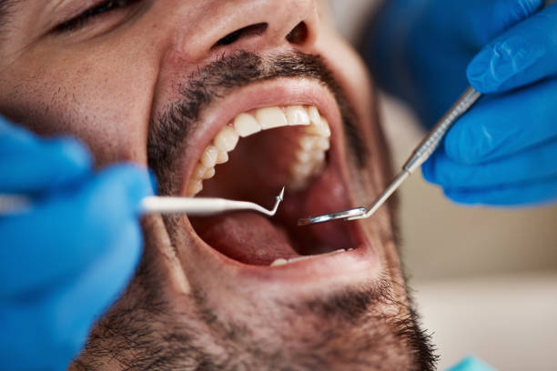 Best Urgent Tooth Repair  in La Plata, MO