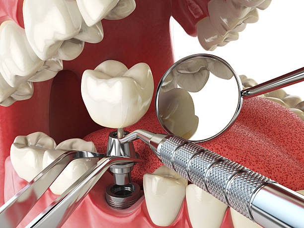 Best Tooth Infection Emergency Dentist  in La Plata, MO